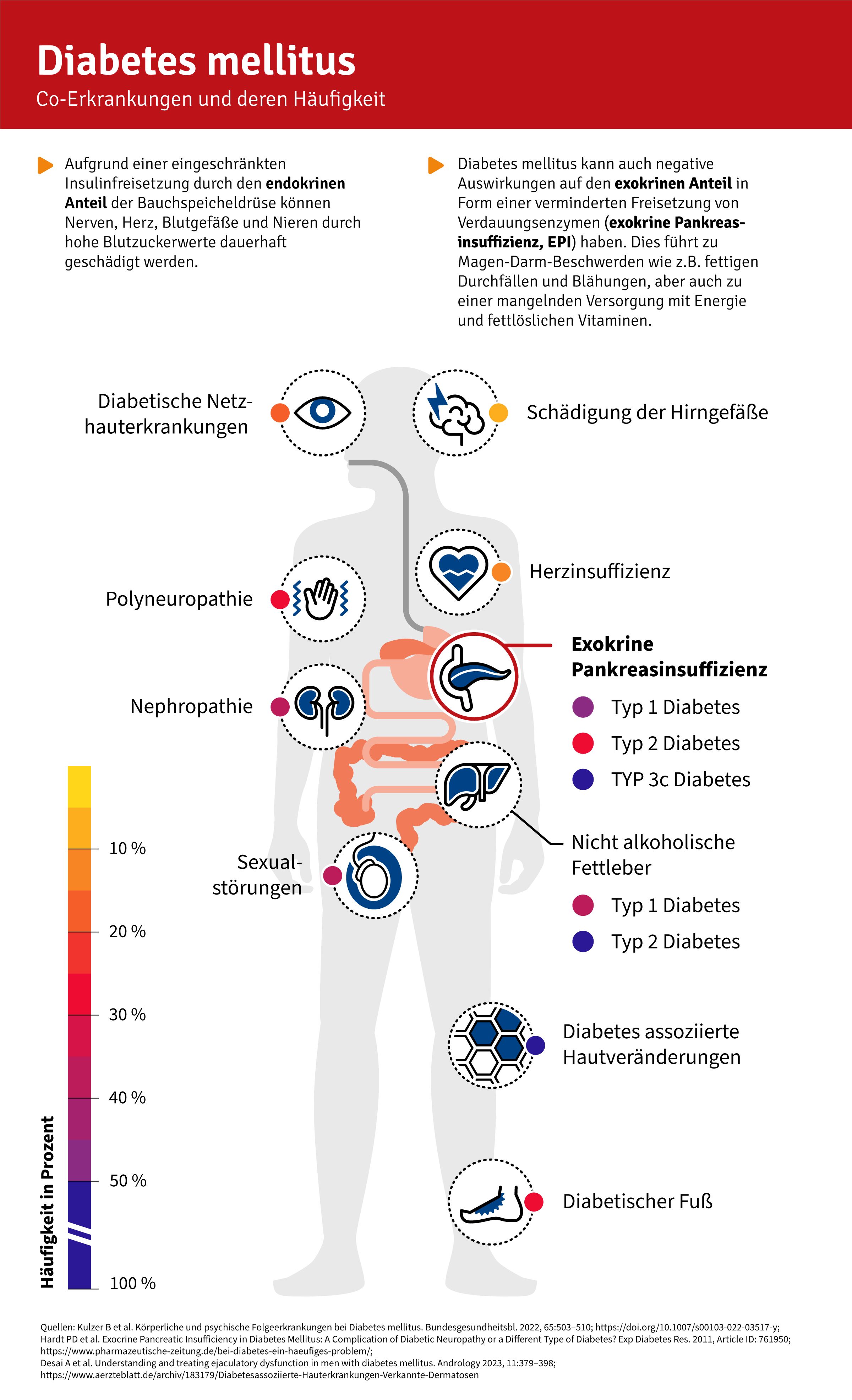 Unterschätzte Gefahr bei Diabetes mellitus Unterzuckerungen durch ...