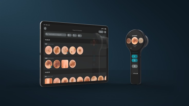 Magnosco bringt innovative Technologie zur Hautkrebsdiagnostik auf den Markt / Magnos® mit App: Digitales, smartes Dermatoskop mit Multi-Touch-Display und hoher Farbtreue