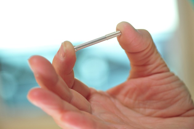 MAGNEZIX® - das Metallimplantat, das zu Knochen wird: Folgeoperationen zur Metallentfernung bei Hallux valgus nicht mehr nötig