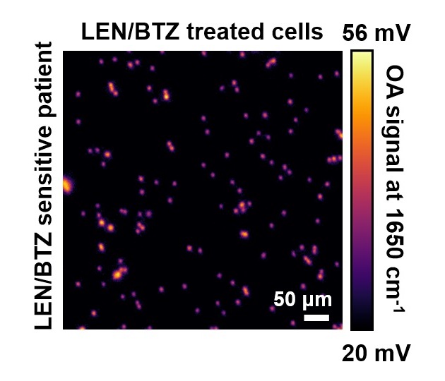 New Label-Free Imaging Tracks Cancer Treatment in Single Cells