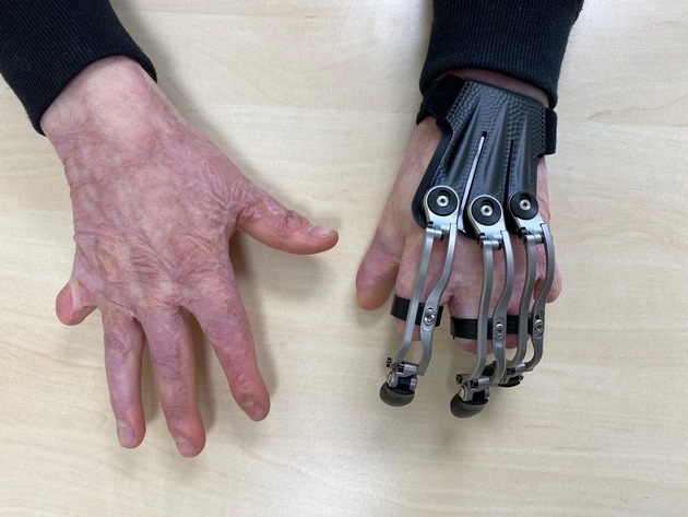 OTWorld: Nach schwersten Verbrennungen zur&uuml;ck in den Alltag