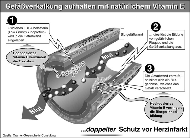 Herzinfarkt durch überhöhte Blutfette / Gefäßverkalkung stoppen - Gesunde Adern mit natürlichem Vitamin E