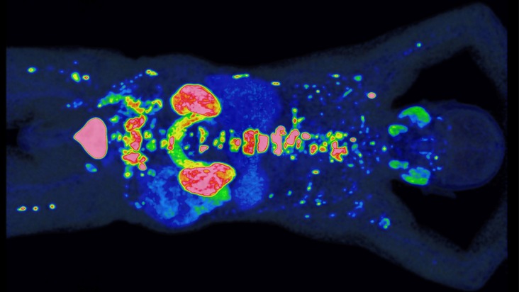 PROMISE erhält Preis der Deutschen Hochschulmedizin: Neue Methode verbessert Prognose und Therapie von Prostatakrebs