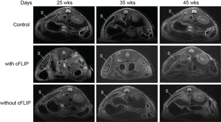 Neue Angriffsstelle zur Behandlung von Lymphomen entdeckt