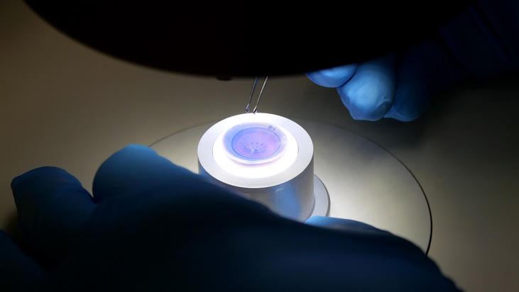Deutsche Gesellschaft f&uuml;r Gewebetransplantation gGmbH: DGFG ver&ouml;ffentlicht Jahresbericht 2025: Starker Anstieg in der Gewebespende / DGFG realisiert 12 Prozent mehr Gewebespenden in 2025