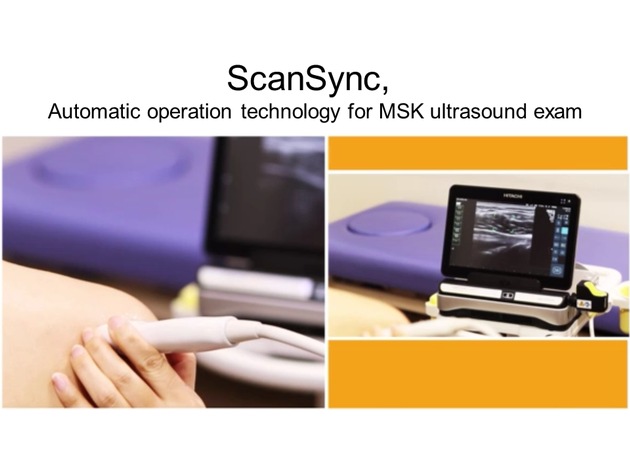 Hitachi Medical Systems Europe announces &quot;ScanSync&quot; - a new function for diagnostic ultrasound that reduces the burden on operators - which is to be supported by the &quot;ARIETTA Prologue&quot;