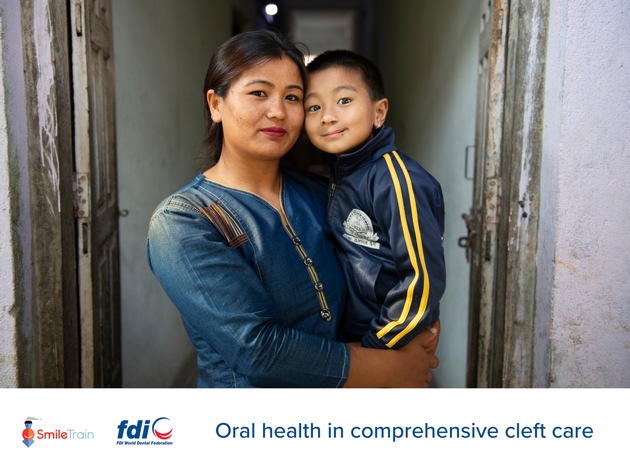 How we can all help improve standards of care for children with clefts to optimize their oral health / FDI World Dental Federation (FDI) releases new educational resources to mark World Smile Day®