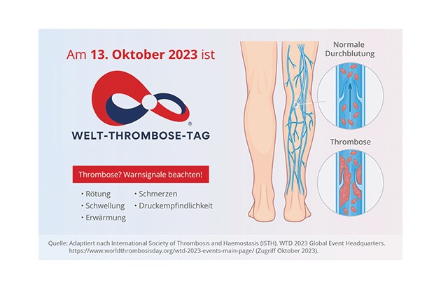 Pressemitteilung: Viatris unterstützt den Welt-Thrombose-Tag 2023: Bewusstsein schärfen – Thrombosen frühzeitig erkennen und behandeln