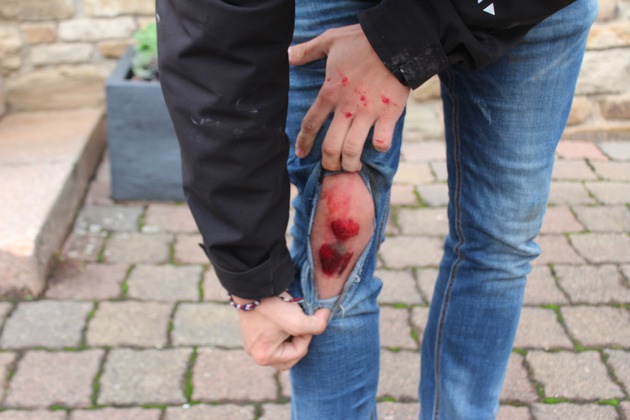 POL-PDKL: Kleinkraftrad-Fahrer leicht bei Kollision mit LKW-Zug verletzt