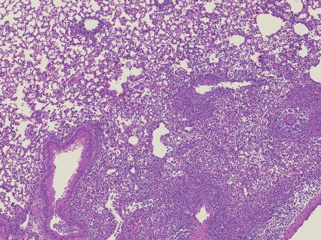 DFG fördert Essener Immunforscherin: Was Schilddrüsenhormone mit Grippe und Krebs zu tun haben könnten