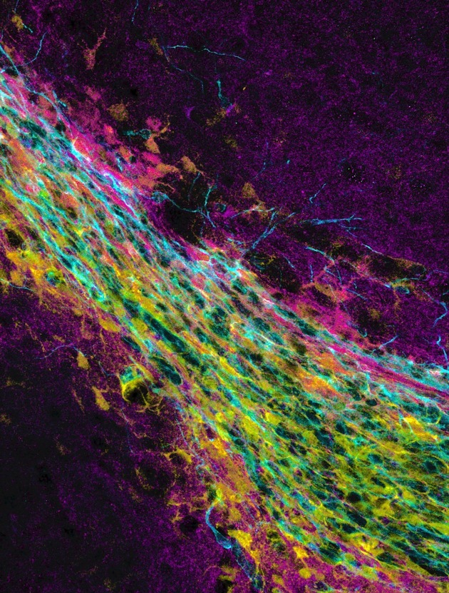 Harte Zeiten stehen bevor: Neurogenese ist nur in steifen Hirnregionen möglich