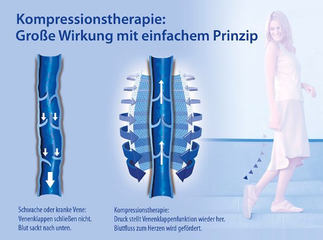 Kompressionstherapie / Wirksam vorbeugen für Beine in Bestform (BILD)