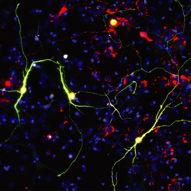 Forschende verbessern neuronale Reprogrammierung durch Manipulation der Mitochondrien