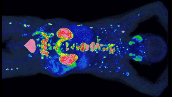 PROMISE erhält Preis der Deutschen Hochschulmedizin: Neue Methode verbessert Prognose und Therapie von Prostatakrebs