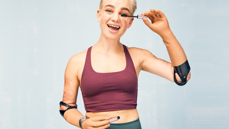 Neue Initiative von und für Menschen mit Armprothesen