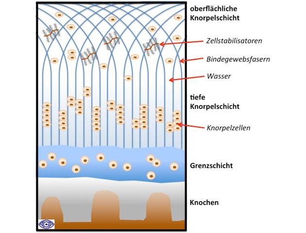 Zusammenhang zwischen Knorpelschädigung und Arthrose: Die AGA, Europas größte Gesellschaft für Arthroskopie und Gelenkchirurgie, informiert