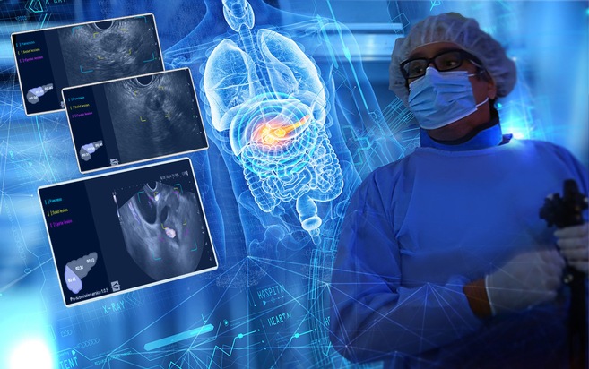 Medi-Globe Launches mAI Companion® - the World’s First Real‑Time AI Assistant for Pancreatic EUS, Co‑Developed with IHU Strasbourg / Now MDR CE‑Marked and Available for Clinical Use in Europe