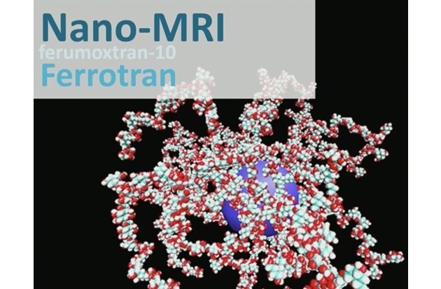 SPL medical B.V.: MRT-Kontrastmittel - was kommt nach Gadolinium / Ferrotran® (Ferumoxtran) für Imaging beim Prostatakarzinom / Imaging ohne Gadolinium in der letzten Phase der Zulassung