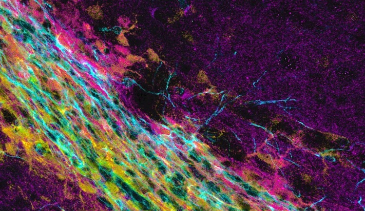 Harte Zeiten stehen bevor: Neurogenese ist nur in steifen Hirnregionen möglich