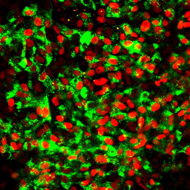 Stammzellen werden zu Betazellen: Neue Chancen für die Zellersatztherapie