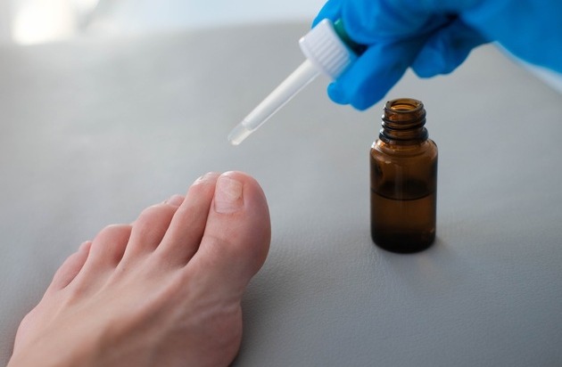 BPI Bundesverband der Pharmazeutischen Industrie: Fuß- und Nagelpilz richtig behandeln