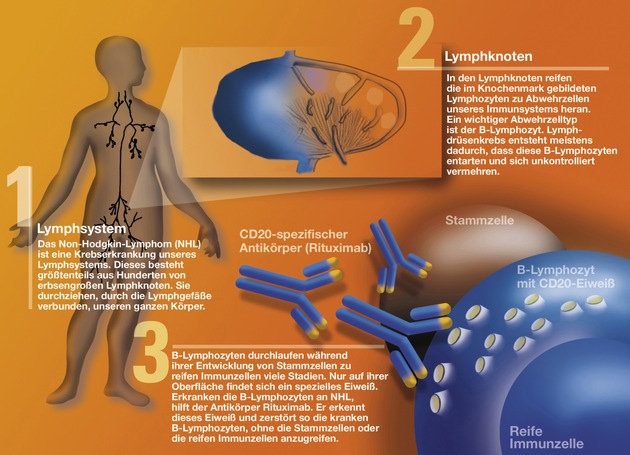 Lymphome sind heilbar / Neue Therapie kann jährlich 1.000 Menschenleben retten