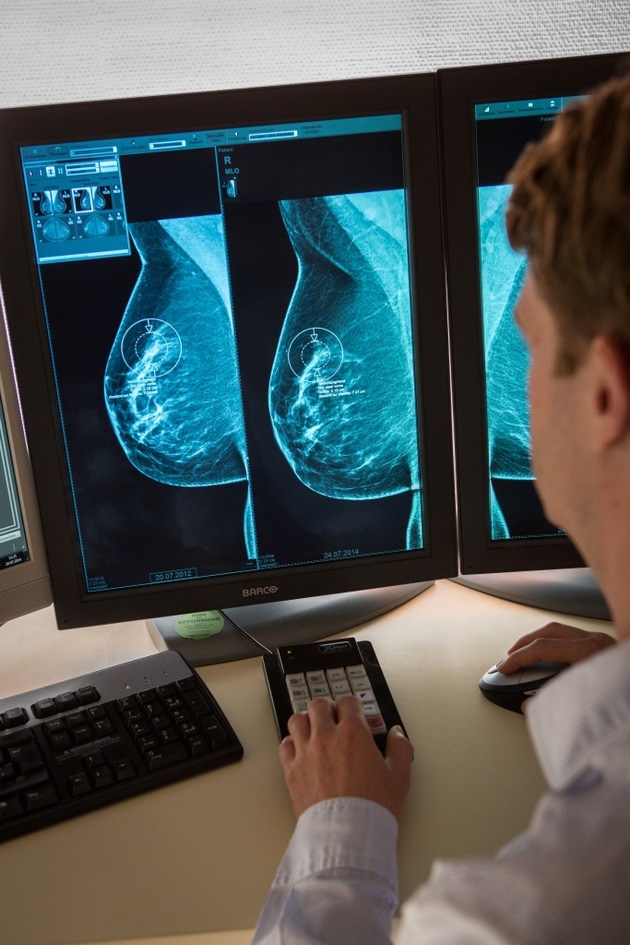 Je älter die Screening-Teilnehmerin, desto wahrscheinlicher ist eine Brustkrebsdiagnose / Aktuelle Auswertung zum deutschen Mammographie-Screening-Programm liegt vor