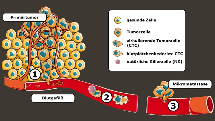 Prostatakrebs heilen - geht das? / Warum Immuntherapie die Lösung sein könnte