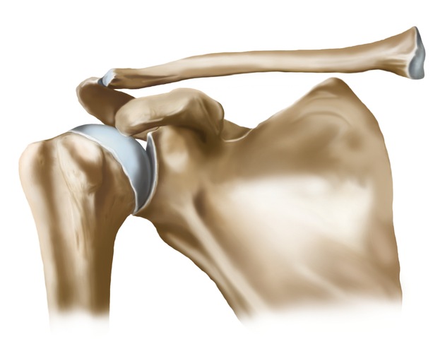 Anatomie, Diagnose, effektive Therapie - Hilfe für starke Schultern mit Orthesen und Bandagen