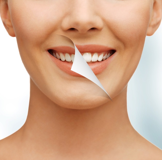 Bleaching war gestern: Strahlend weiße Zähne mit der schonenden WHITE-Behandlung