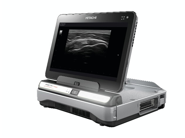 Hitachi Medical Systems Europe announces &quot;ScanSync&quot; - a new function for diagnostic ultrasound that reduces the burden on operators - which is to be supported by the &quot;ARIETTA Prologue&quot;
