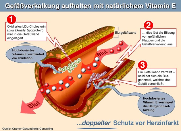 Herzinfarkt durch überhöhte Blutfette / Gefäßverkalkung stoppen - Gesunde Adern mit natürlichem Vitamin E