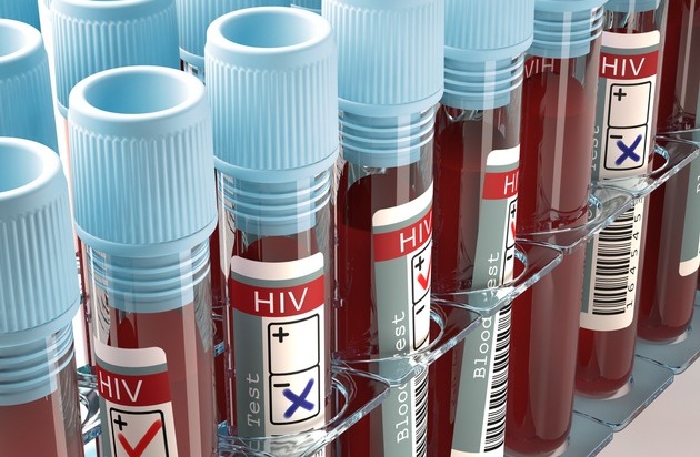 BPI Bundesverband der Pharmazeutischen Industrie: Mit HIV alt werden - Fortschritte in der AIDS-Therapie