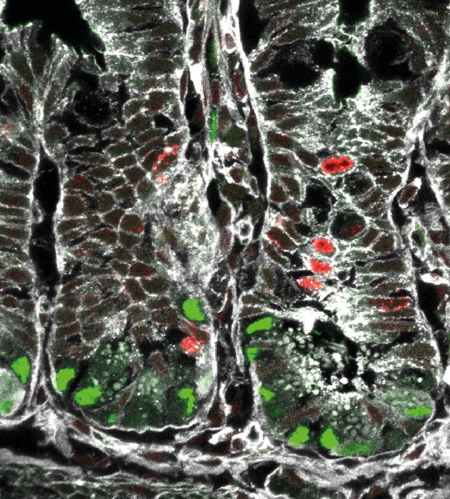 Stammzellen im Darm: Neue Erkenntnisse könnten Weg für die Behandlung zahlreicher Krankheiten ebnen