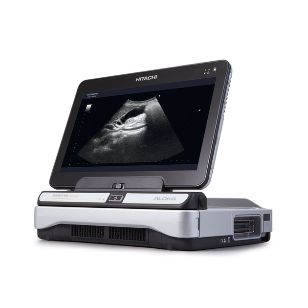 Hitachi Aloka launches two new, highly flexible Diagnostic Ultrasound Systems, ARIETTA Precision and ARIETTA Prologue