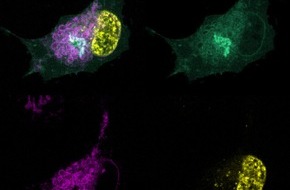 Helmholtz Zentrum München: Identifizierung eines Ferroptose-Suppressor-Proteins ermöglicht einen neuen Ansatz zur Behandlung von Krebs