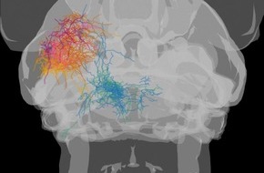 Universit&auml;t Konstanz: Wie das Gehirn mit widerspr&uuml;chlichen visuellen Reizen umgeht, PI Nr. 28/2026