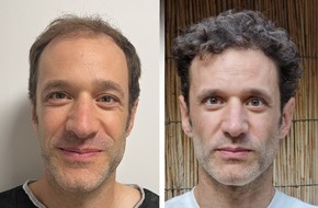 Hermest Hair Clinic: Haartransplantation T&uuml;rkei Testsieger 2026: Die 10 besten Kliniken im gro&szlig;en Vergleich