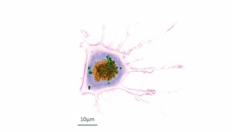 Nanolive SA: Haben Sie sich schon mal gefragt wie lebende Zellen von Innen aussehen? - BILD