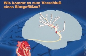 Boehringer Ingelheim: Ein Schlaganfall kommt selten allein / Neue Perspektiven der Boehringer Ingelheim-Forschung zur Verhinderung von Schlaganfällen
