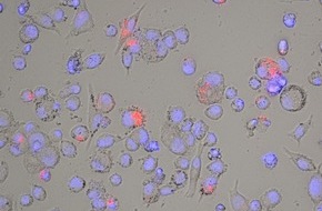 Mukoviszidose e.V.: Mukoviszidose e.V. finanziert Forschungsprojekt zur Mycobacterium abscessus-Therapie