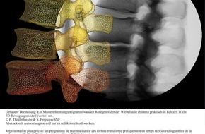 Schweizerischer Nationalfonds / Fonds national suisse: FNS: Image de la recherche: Nouvelle méthode plus précise d'examen médical