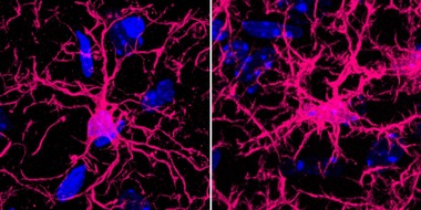 Albert-Ludwigs-Universität Freiburg: Anti-Aging fürs Gehirn? Studie liefert neue Erkenntnisse über altersbedingte Hirnveränderungen