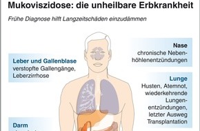 Mukoviszidose e.V.: Mukoviszidose e.V. begrüßt Entscheidung des G-BA / Screening auf Mukoviszidose bald für alle Neugeborenen in Deutschland