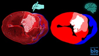 Universität Duisburg-Essen: Herzinfarktanalyse in 20 Sekunden: Schnellere Messergebnisse dank KI