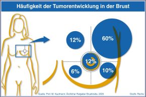 Kostenfreie Infografiken der Roche Pharma AG zum Thema Krebs (mit Bild)
