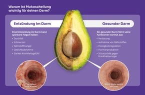 AbbVie Deutschland GmbH & Co. KG: Magen-Darm-Tag am 7. November / Mukosaheilung als Schlüssel zu mehr Lebensqualität