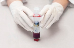Arthrex: Bioregenerative Therapie von Arthrosen und Sportverletzungen - Mit ACP aus dem eigenen Blut direkt in Gelenke, Muskeln oder Sehnen