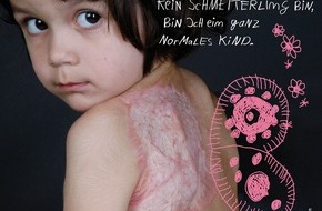 Feuerwehr Weinheim: FW Weinheim: Tag des brandverletzten Kindes Gemeinsam Kraft geben, Prävention stärken