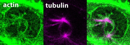 Albert-Ludwigs-Universität Freiburg: Einzigartige Eigenschaften von bisher unerforschtem Protein entdeckt